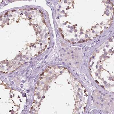 Immunohistochemistry-Paraffin: TP53TG5 Antibody [NBP2-13467]