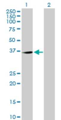 Western Blot: TP53TG5 Antibody [H00027296-B01P]