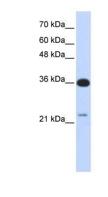 Western Blot: TP53TG5 Antibody [NBP1-58924]