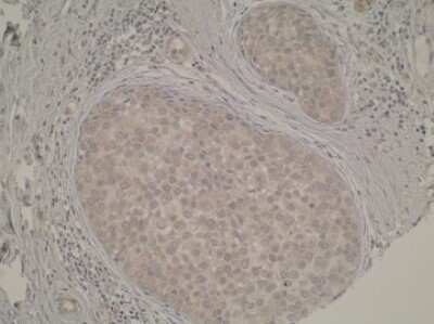 Immunohistochemistry-Paraffin: TP53TG5 Antibody (Z38P1E4*C7) - BSA Free [NBP2-50338]