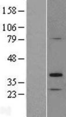 Western Blot: TP53TG5 Overexpression Lysate [NBL1-08353]