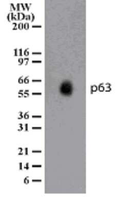 Western Blot: p63/TP73L Antibody (87C553) [NB100-56549]