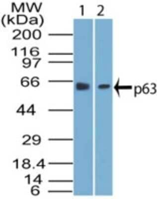 Western Blot: p63/TP73L Antibody (87C553) [NB100-56549]