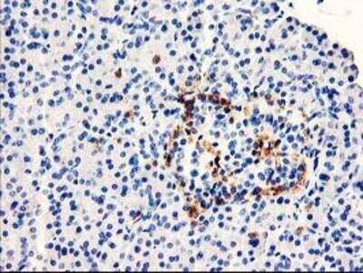 Immunohistochemistry-Paraffin: TP73-AS1 Antibody (OTI2B9) [NBP2-01283]