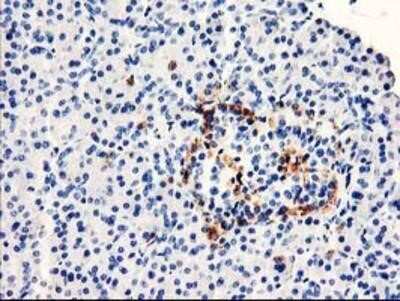 Immunohistochemistry: TP73-AS1 Antibody (OTI2B9) - Azide and BSA Free [NBP2-74559]
