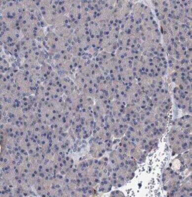 Immunohistochemistry-Paraffin: TPCN1 Antibody [NBP1-83642]