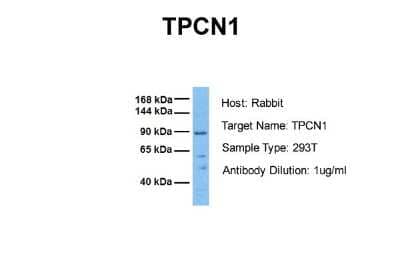 Western Blot: TPCN1 Antibody [NBP2-83709]