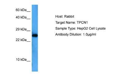 Western Blot: TPCN1 Antibody [NBP2-83710]