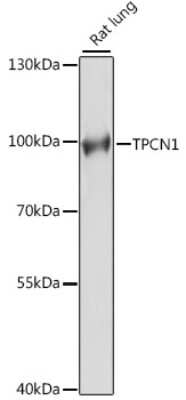 Western Blot: TPCN1 AntibodyAzide and BSA Free [NBP2-94265]