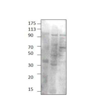 Western Blot: TPCN1 Antibody [NBP3-12503]