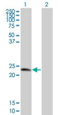 Western Blot: TPD52 Antibody (1B6) [H00007163-M01]