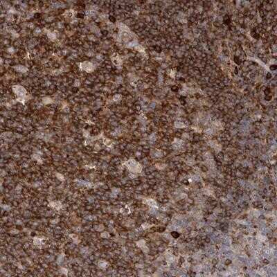 Immunohistochemistry-Paraffin: TPD52 Antibody [NBP1-85327]