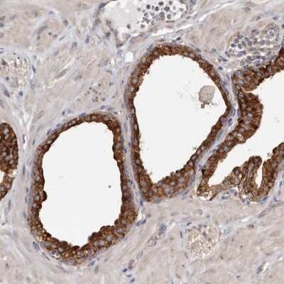 Immunohistochemistry-Paraffin: TPD52 Antibody [NBP1-85327]