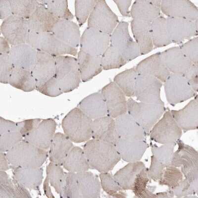 Immunohistochemistry-Paraffin: TPD52 Antibody [NBP1-85327]