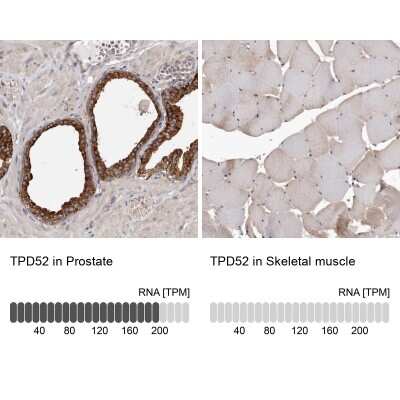 Immunohistochemistry-Paraffin: TPD52 Antibody [NBP1-85327]