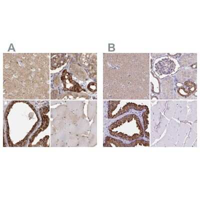 Immunohistochemistry-Paraffin: TPD52 Antibody [NBP1-85327]