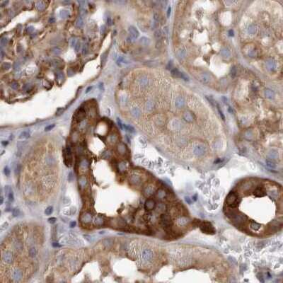 Immunohistochemistry-Paraffin: TPD52 Antibody [NBP1-85327]