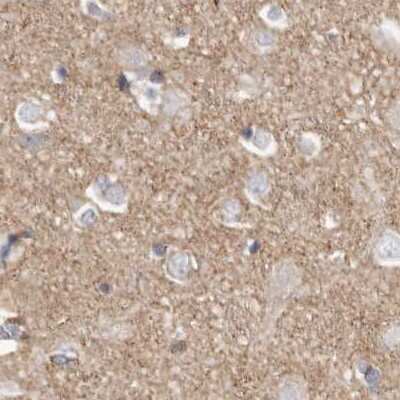 Immunohistochemistry-Paraffin: TPD52 Antibody [NBP1-85327]