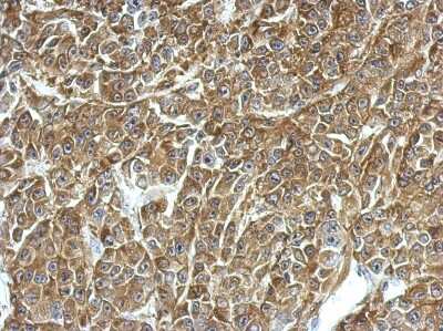 Immunohistochemistry-Paraffin: TPD52 Antibody [NBP2-20686]