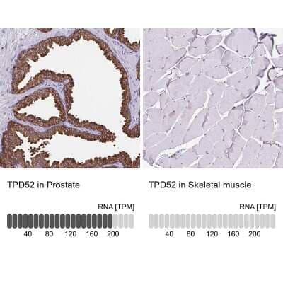 Immunohistochemistry-Paraffin: TPD52 Antibody [NBP2-38952]