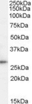 Western Blot: TPD52 Antibody [NBP1-06090]