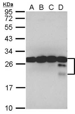 Western Blot: TPD52 Antibody [NBP2-20686]