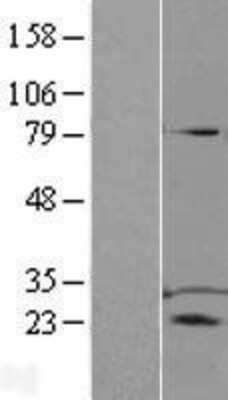 Western Blot: TPD52 Overexpression Lysate [NBL1-17212]