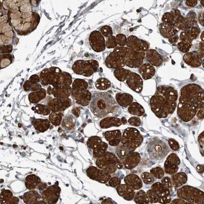 Immunohistochemistry-Paraffin: TPD52L1/D53 Antibody [NBP1-84313]