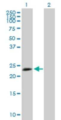 Western Blot: TPD52L1/D53 Antibody [H00007164-B02P]