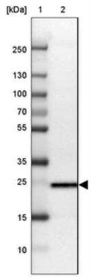 Western Blot: TPD52L1/D53 Antibody [NBP1-84314]