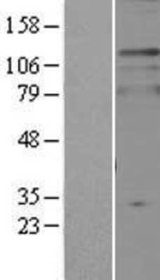 Western Blot: TPD52L2/D54 Overexpression Lysate [NBP2-04247]