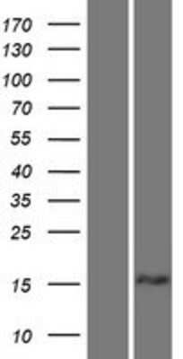 Western Blot: TPD52L1/D53 Overexpression Lysate [NBP2-10737]