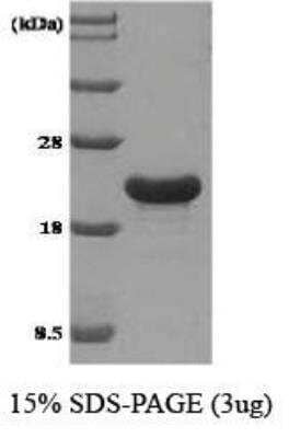 SDS-PAGE: Recombinant Human TPD52L1/D53 His Protein [NBC1-18500]