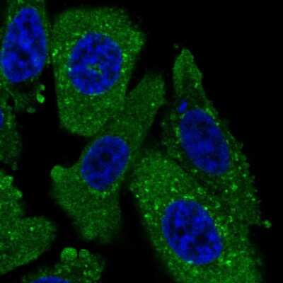 Immunocytochemistry/ Immunofluorescence: TPD52L2/D54 Antibody [NBP2-13468]
