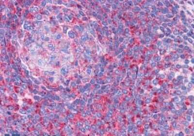 Immunohistochemistry-Paraffin: TPD52L2/D54 Antibody [NBP1-06092]