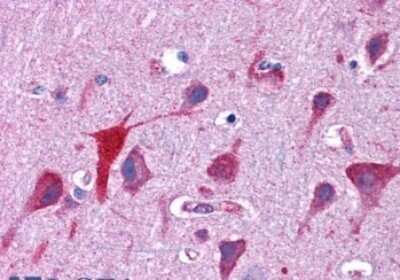 Immunohistochemistry-Paraffin: TPD52L2/D54 Antibody [NBP1-06092]
