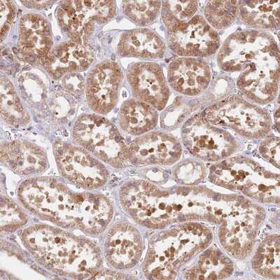 Immunohistochemistry-Paraffin: TPD52L2/D54 Antibody [NBP2-13468]