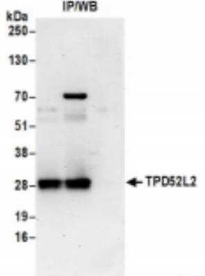 Immunoprecipitation: TPD52L2/D54 Antibody [NBP2-36548]