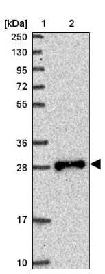 Western Blot: TPD52L2/D54 Antibody [NBP2-13468]