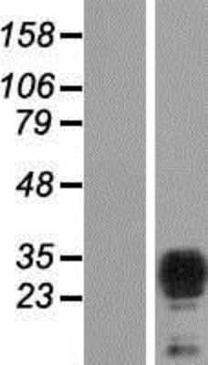 Western Blot: TPD52L2/D54 Overexpression Lysate [NBP2-04612]