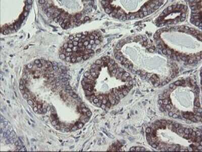 Immunohistochemistry: TPD52L3/D55 Antibody (OTI8C12) [NBP2-46012]