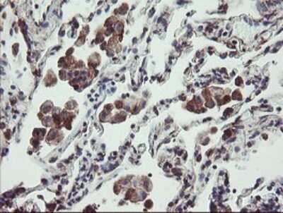 Immunohistochemistry: TPD52L3/D55 Antibody (OTI8C12) [NBP2-46012]