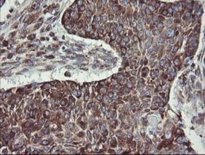 Immunohistochemistry: TPD52L3/D55 Antibody (OTI8C12) [NBP2-46012]