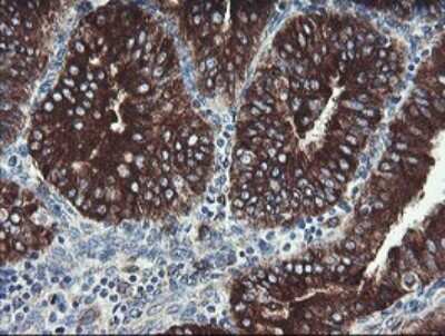 Immunohistochemistry: TPD52L3/D55 Antibody (OTI8C12) [NBP2-46012]