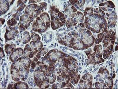 Immunohistochemistry: TPD52L3/D55 Antibody (OTI8C12) [NBP2-46012]