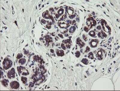 Immunohistochemistry: TPD52L3/D55 Antibody (OTI8C12) [NBP2-46012]