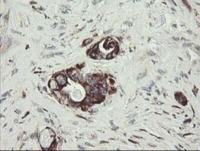 Immunohistochemistry: TPD52L3/D55 Antibody (OTI8C12) [NBP2-46012]