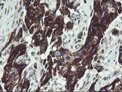 Immunohistochemistry: TPD52L3/D55 Antibody (OTI8C12) [NBP2-46012]