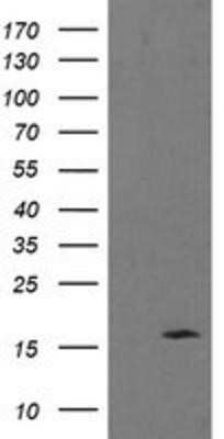 Western Blot: TPD52L3/D55 Antibody (OTI6E1)Azide and BSA Free [NBP2-74565]