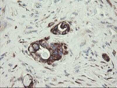 Immunohistochemistry: TPD52L3/D55 Antibody (OTI8C12) - Azide and BSA Free [NBP2-74567]